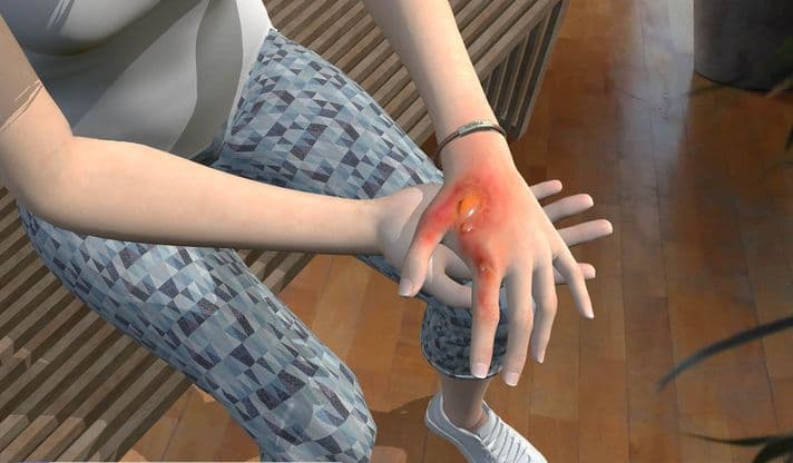 Blessures screenshot2